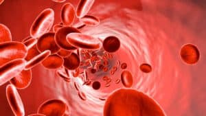 Blutvergiftung homöopathisch behandeln